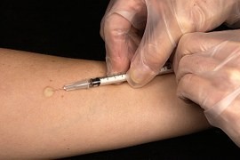 Svět má důležitý lék na TBC, pro rozvojové země je příliš drahý Svět má důležitý lék na TBC, pro rozvojové země je příliš drahý