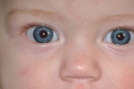 Sledujete pečlivě vývoj zraku u svého dítěte?