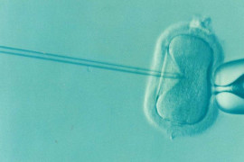Spermiogram se horší, muži ztrácí zájem o sex Spermiogram se horší, muži ztrácí zájem o sex